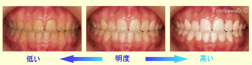 明度の差