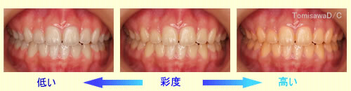 彩度の差